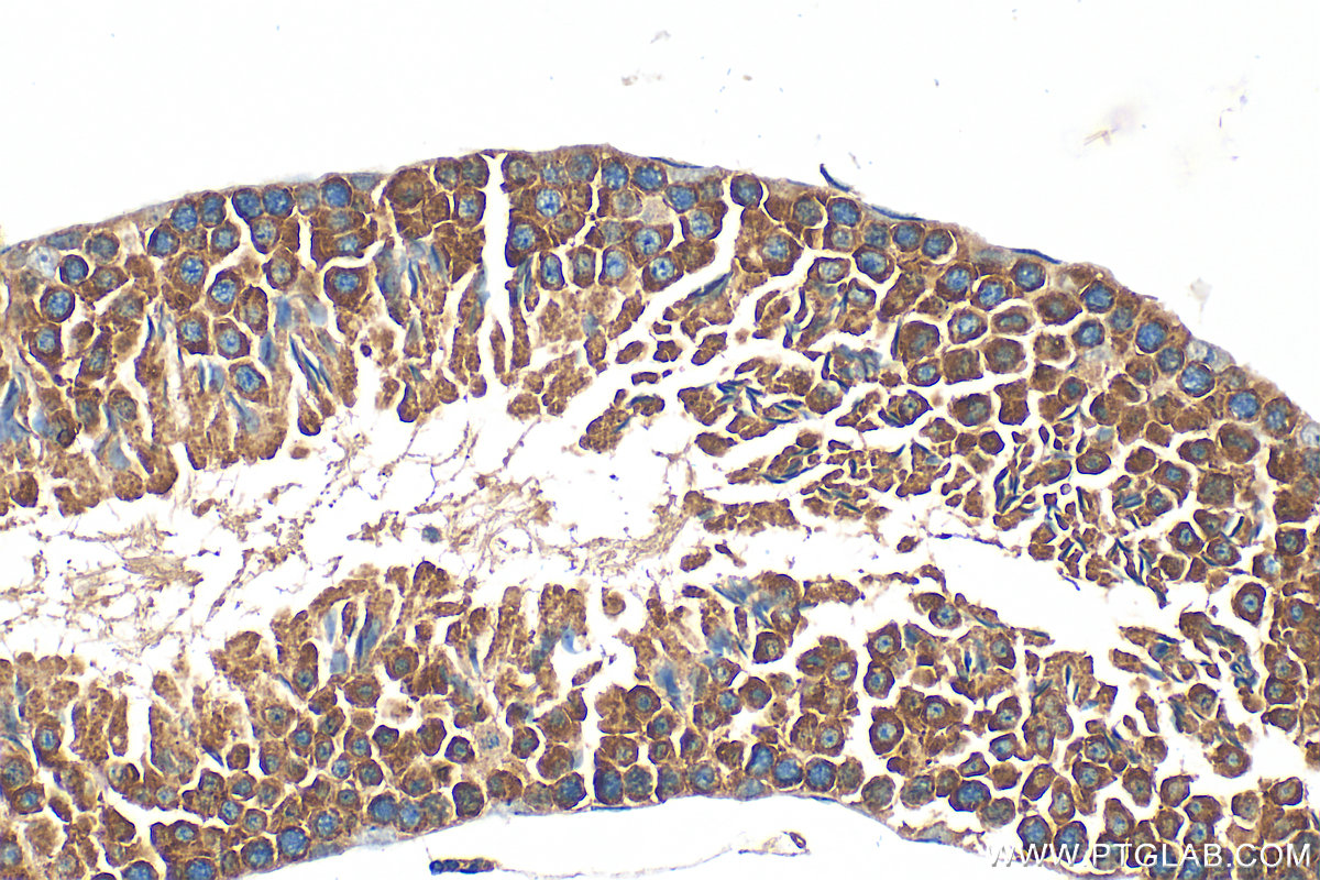 IHC staining of mouse testis using 10702-1-AP