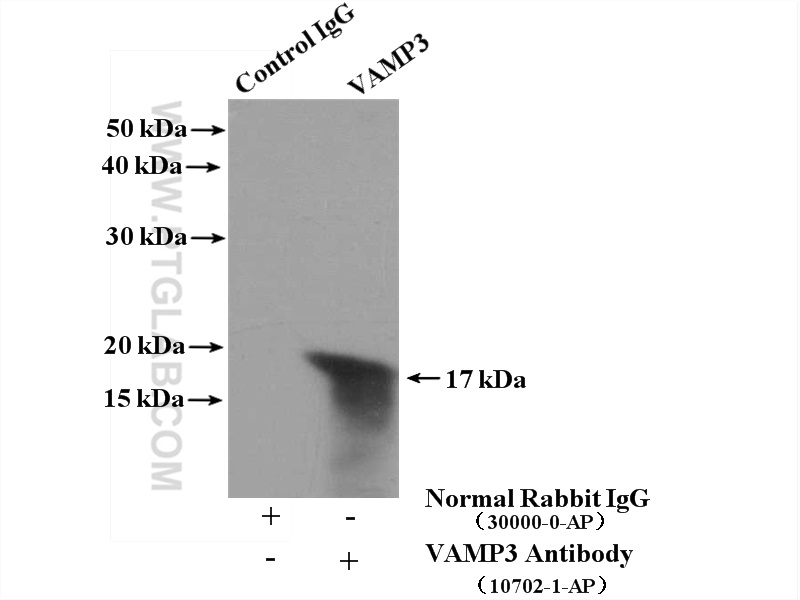 IP experiment of HEK-293 using 10702-1-AP