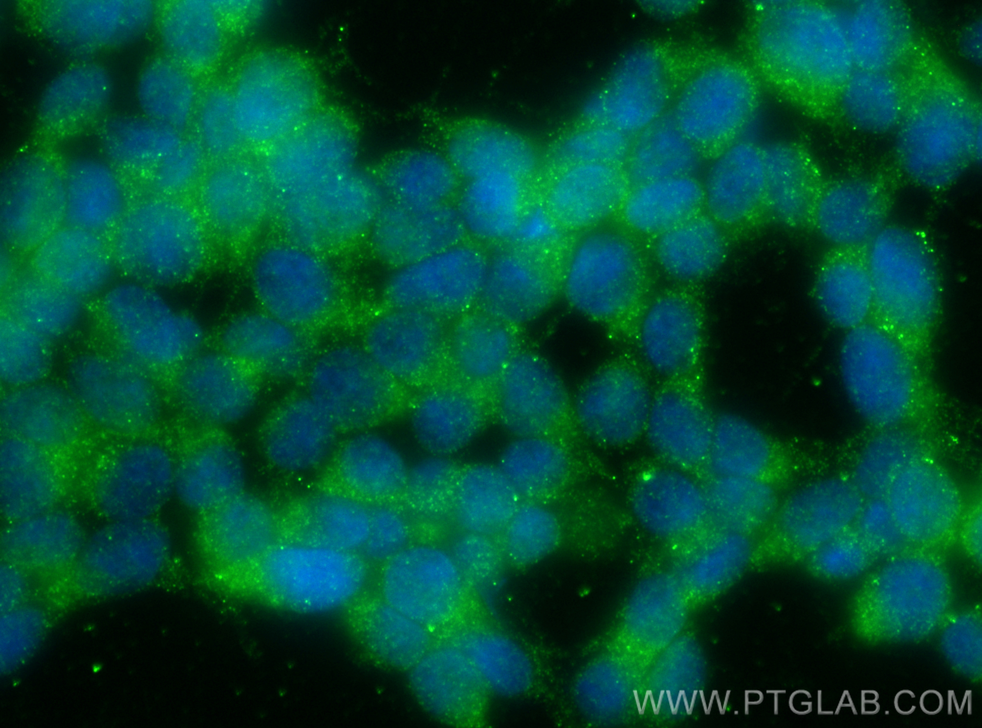 IF Staining of SH-SY5Y using 10738-1-AP
