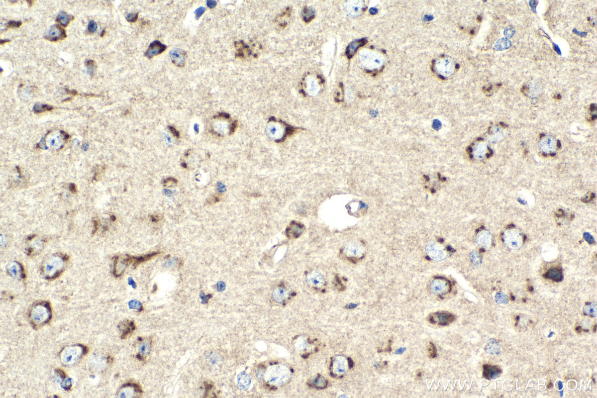 IHC staining of mouse brain using 10738-1-AP