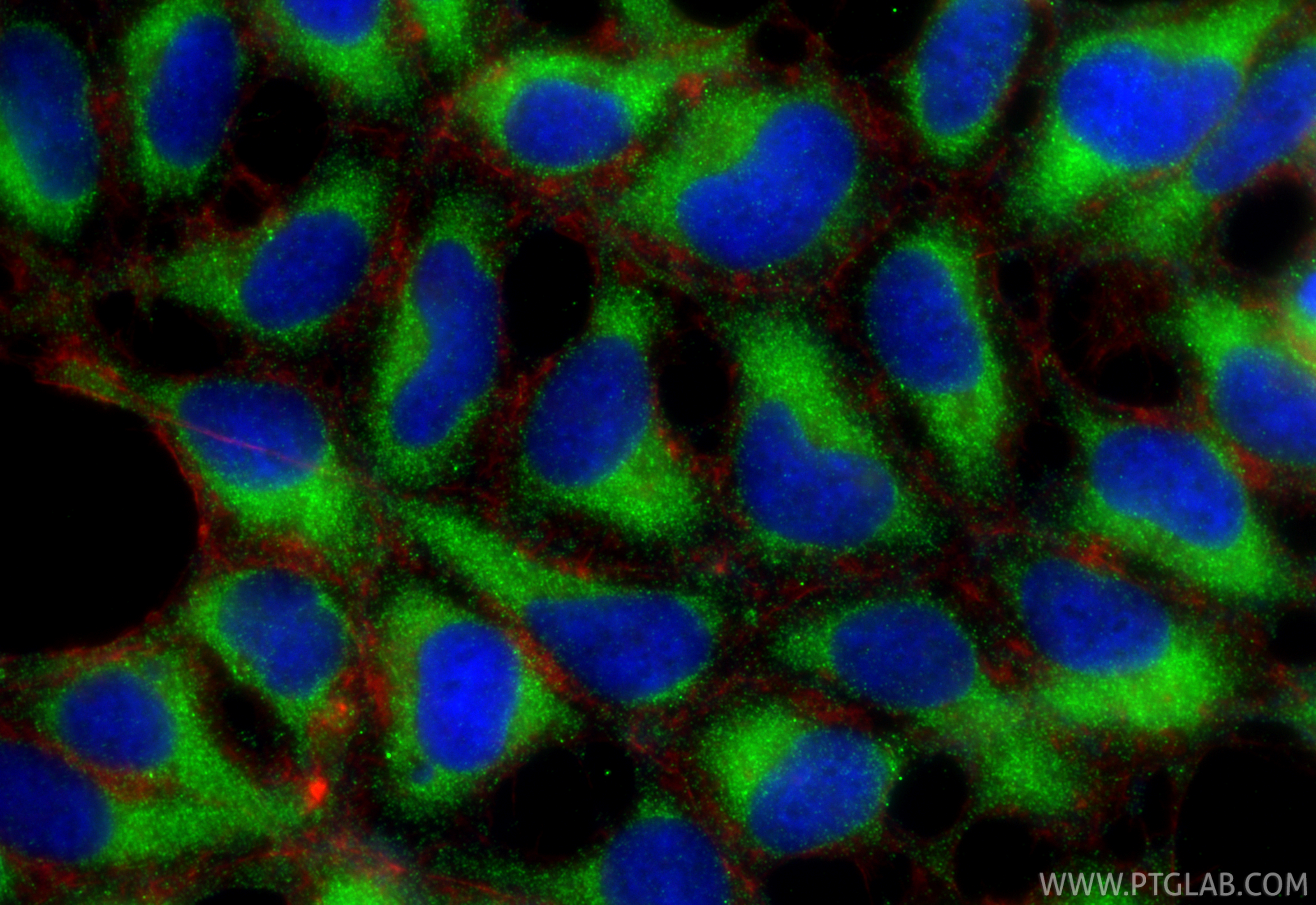 IF Staining of HEK-293 using 67219-1-Ig (same clone as 67219-1-PBS) IF Staining of HEK-293 using 67219-1-Ig (same clone as 67219-1-PBS)