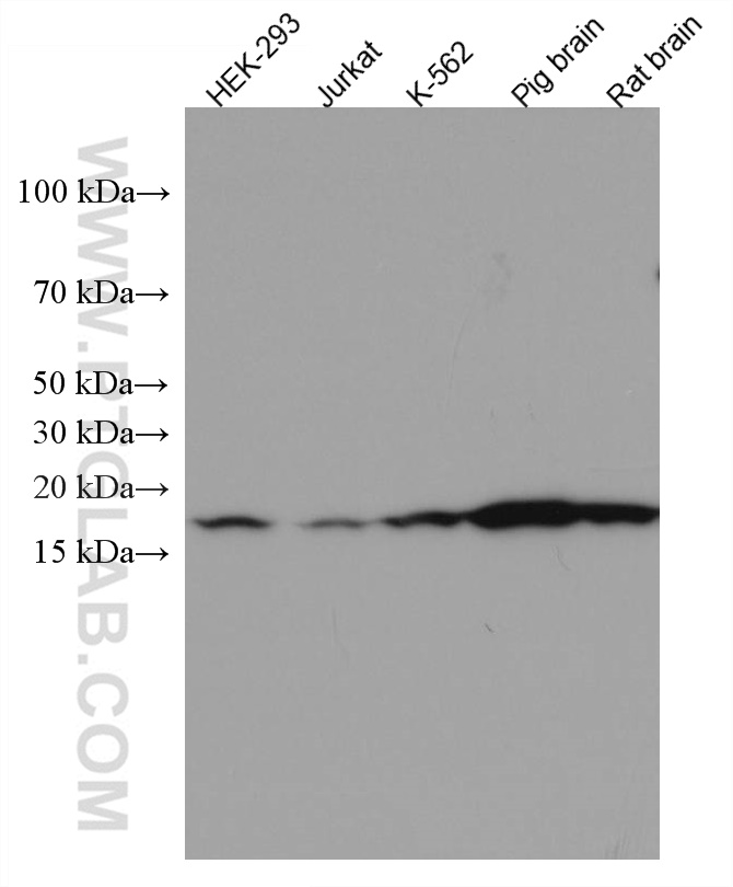 WB analysis using 67219-1-Ig