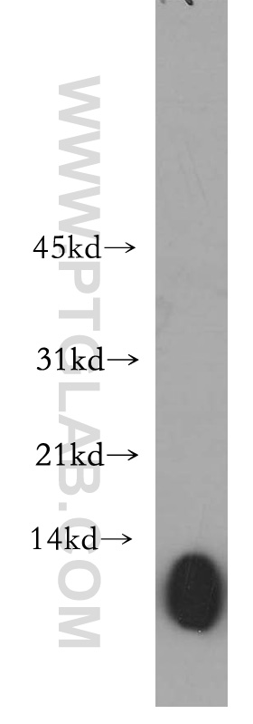 WB analysis of human lung using 11822-1-AP