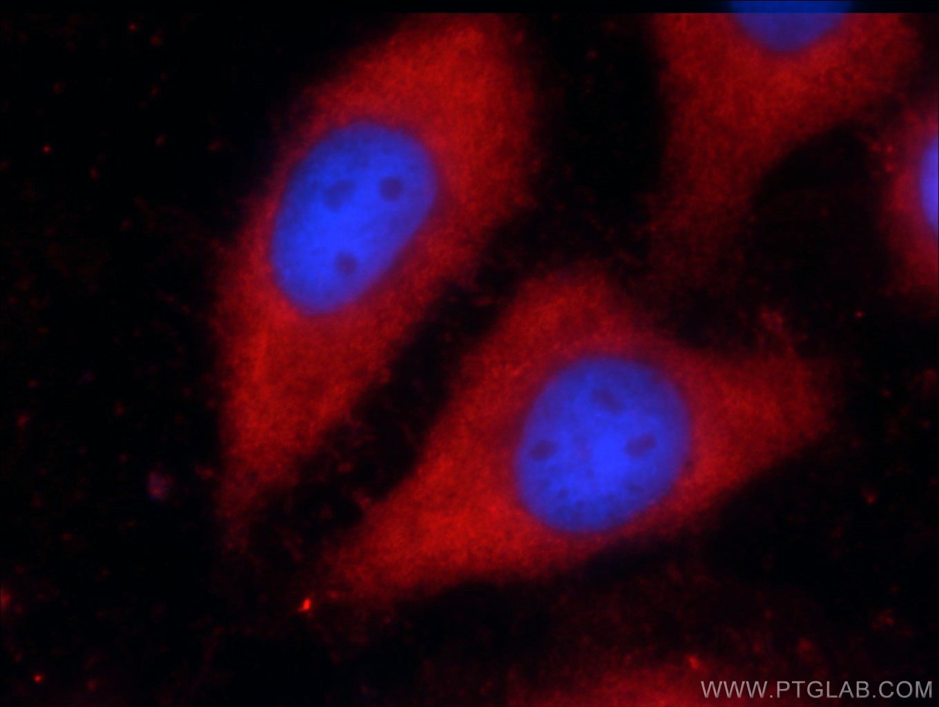 IF Staining of HepG2 using 22268-1-AP