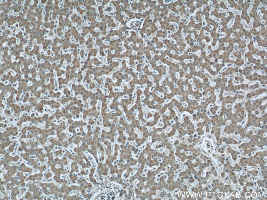 IHC staining of human liver using 22268-1-AP