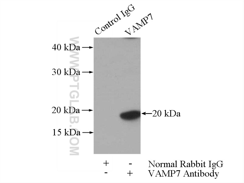 IP experiment of mouse brain using 22268-1-AP