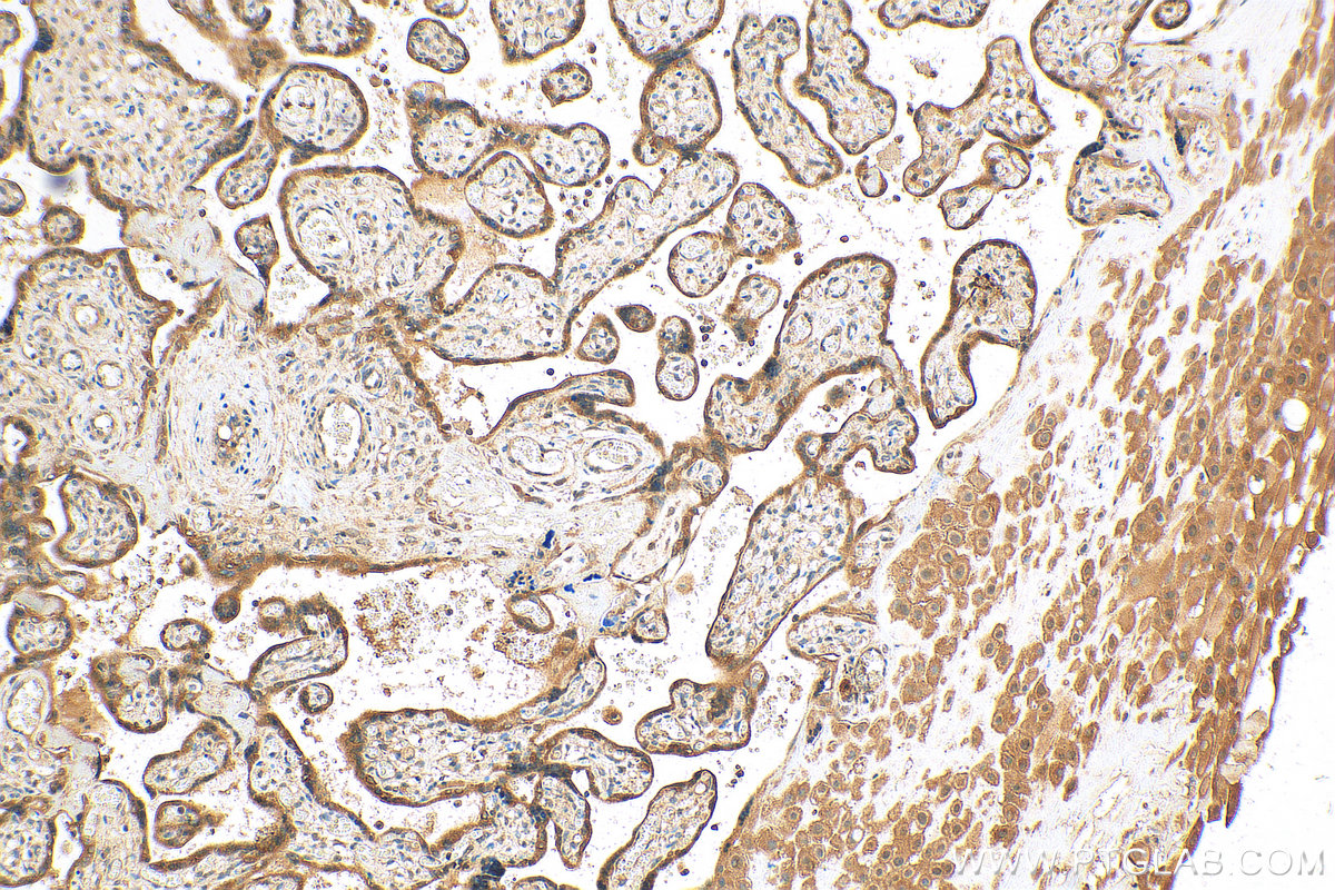 IHC staining of human placenta using 15546-1-AP