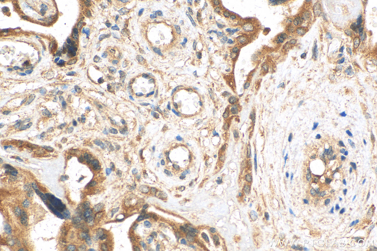 IHC staining of human placenta using 15546-1-AP