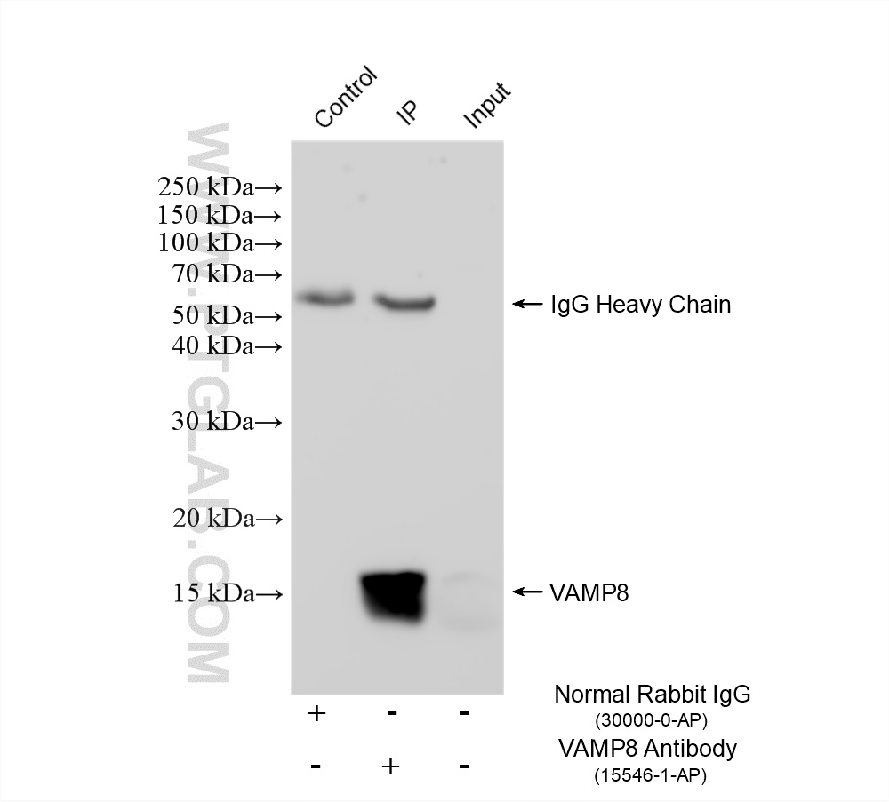 IP experiment of A431 using 15546-1-AP