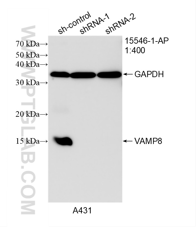 WB analysis of A431 using 15546-1-AP WB analysis of A431 using 15546-1-AP