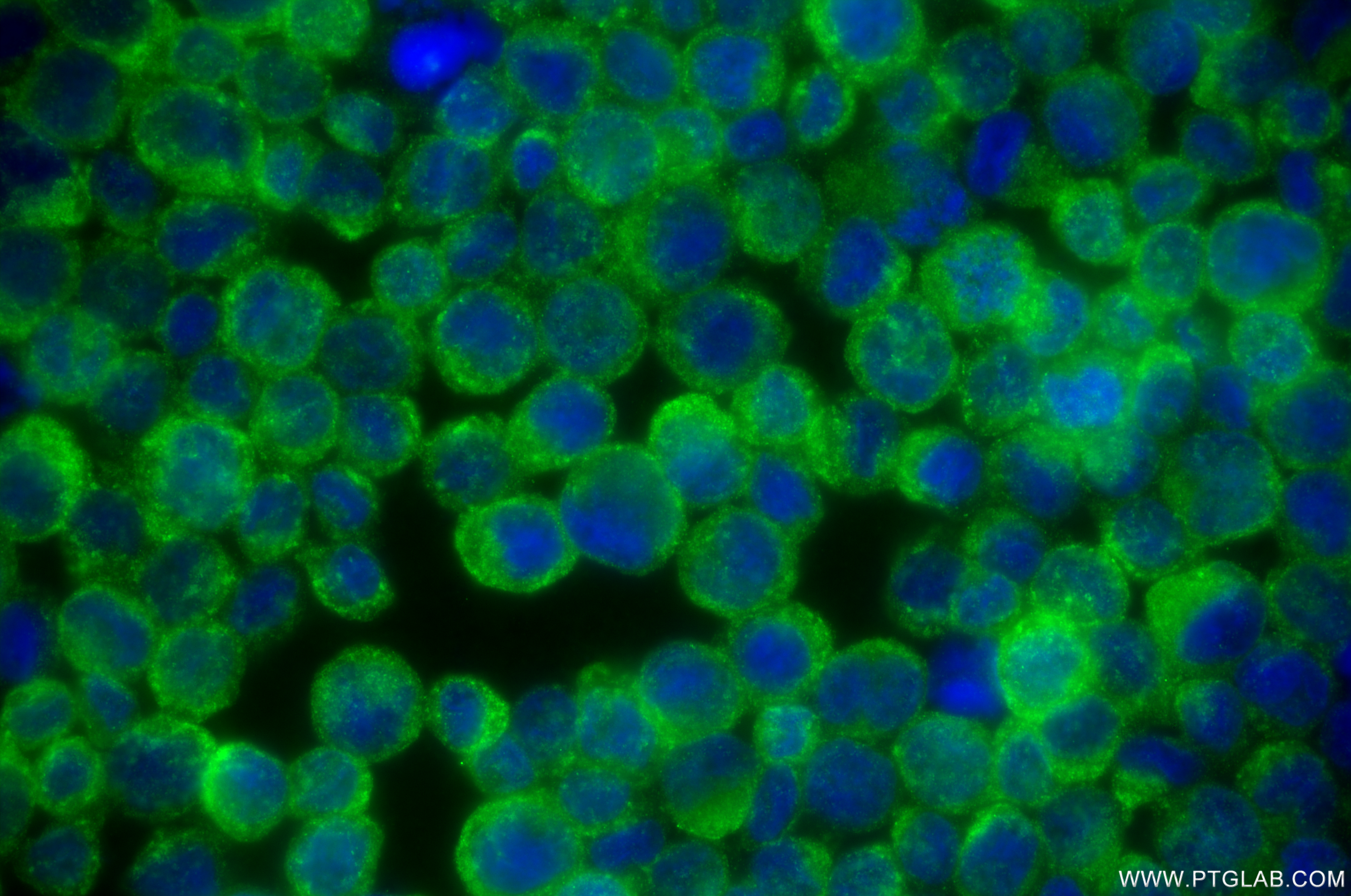 IF Staining of THP-1 using 85400-4-RR (same clone as 85400-4-PBS)