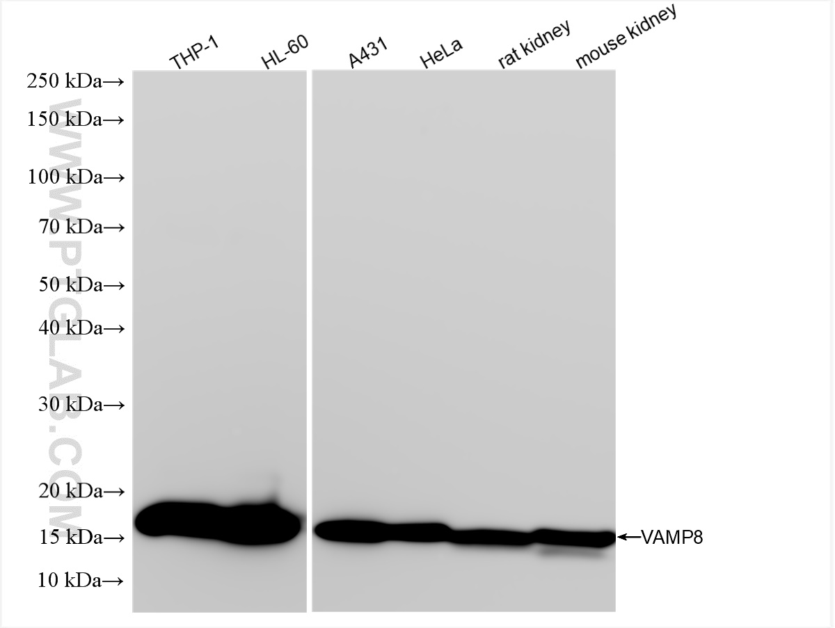 WB analysis using 85400-4-RR (same clone as 85400-4-PBS)