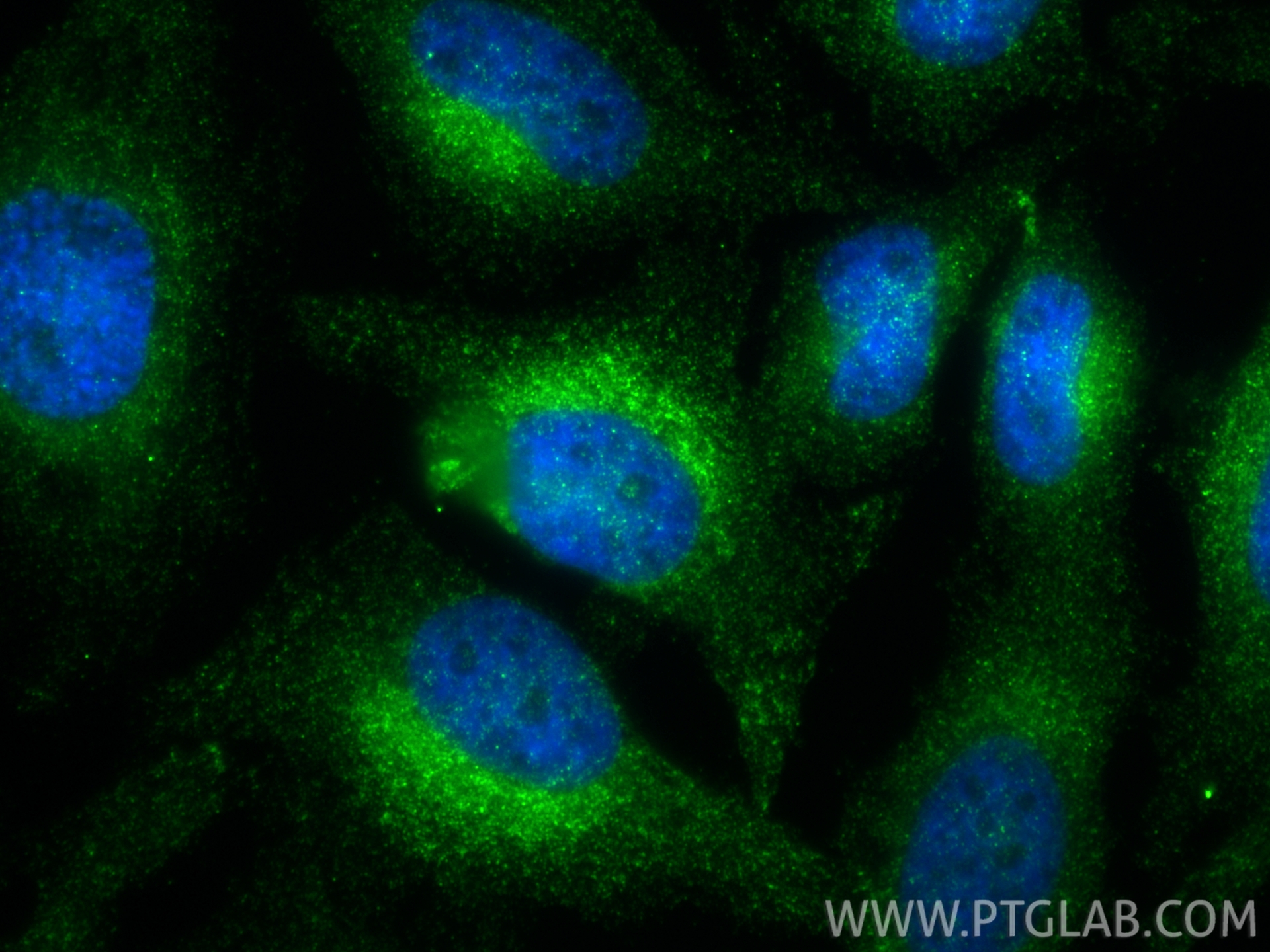 IF Staining of HeLa using RMX00044 IF Staining of HeLa using RMX00044