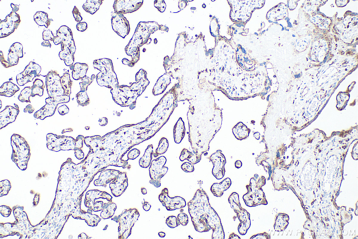 IHC staining of human placenta using RMX00044 IHC staining of human placenta using RMX00044