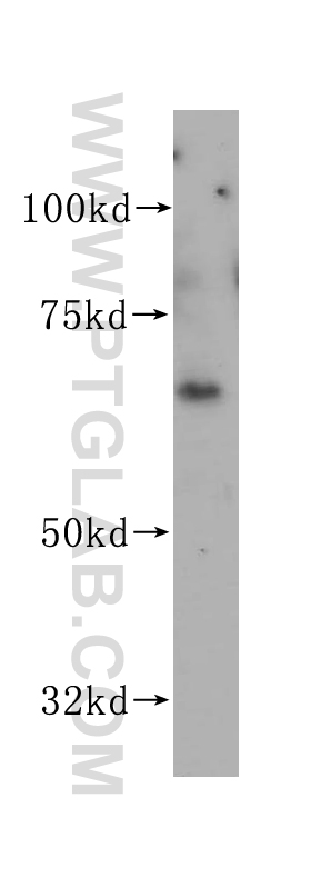 VANGL1 Polyclonal antibody