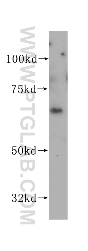 VANGL1
