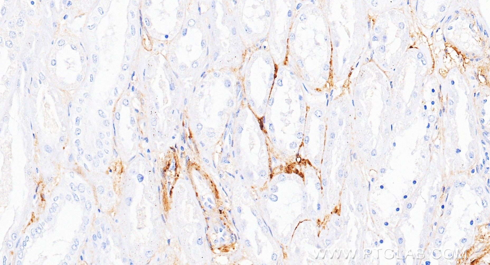 IHC staining of human kidney using 87278-3-RR IHC staining of human kidney using 87278-3-RR