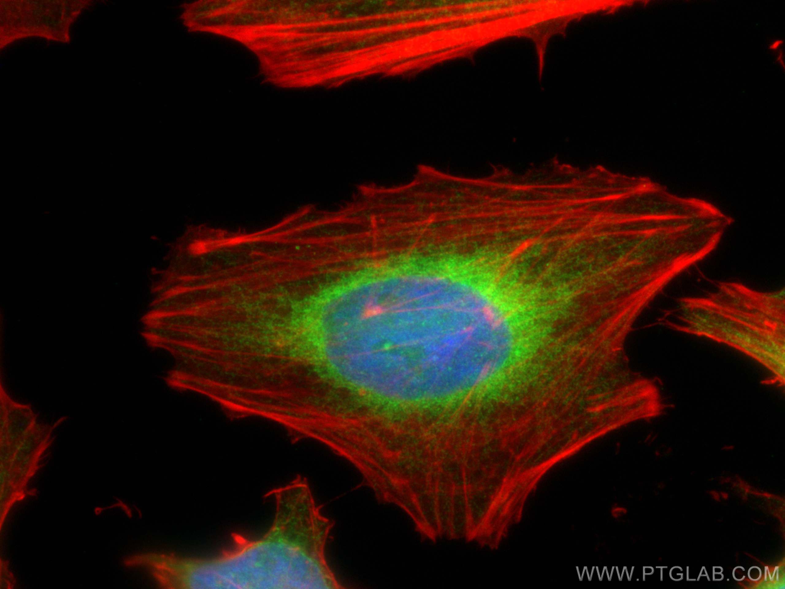 IF Staining of HeLa using 14477-1-AP