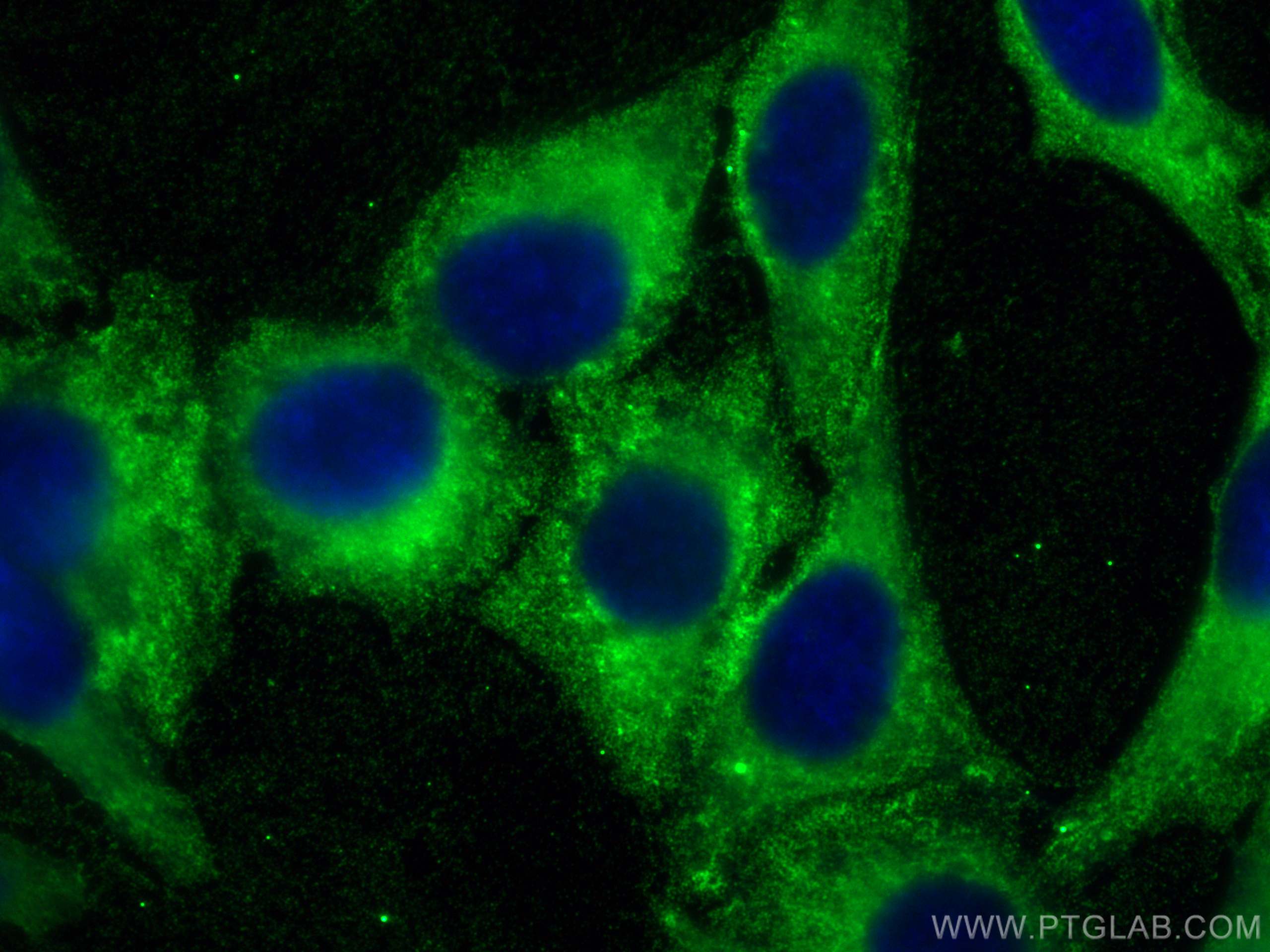 IF Staining of HepG2 using 66191-1-Ig