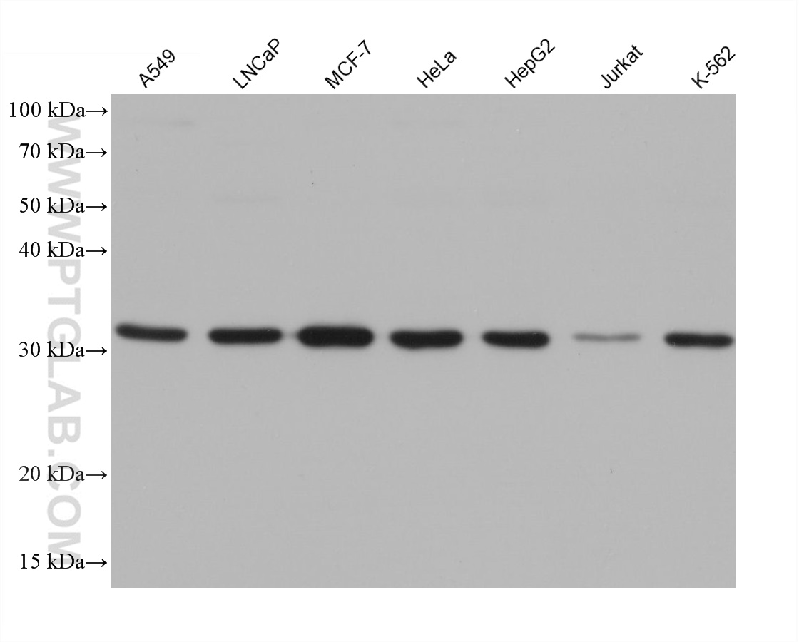 WB analysis using 66191-1-Ig (same clone as 66191-1-PBS)