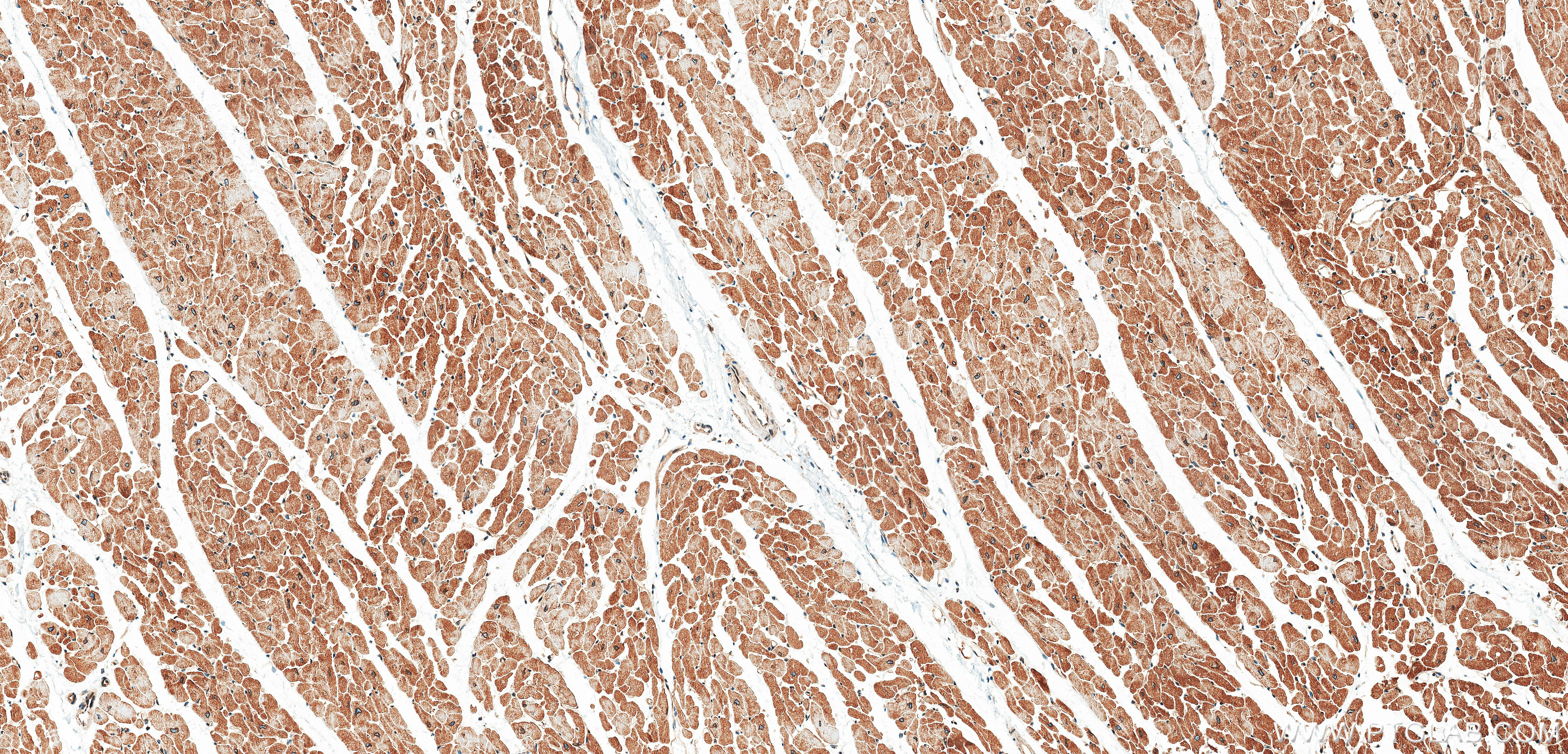 IHC staining of human heart using 87770-3-RR IHC staining of human heart using 87770-3-RR