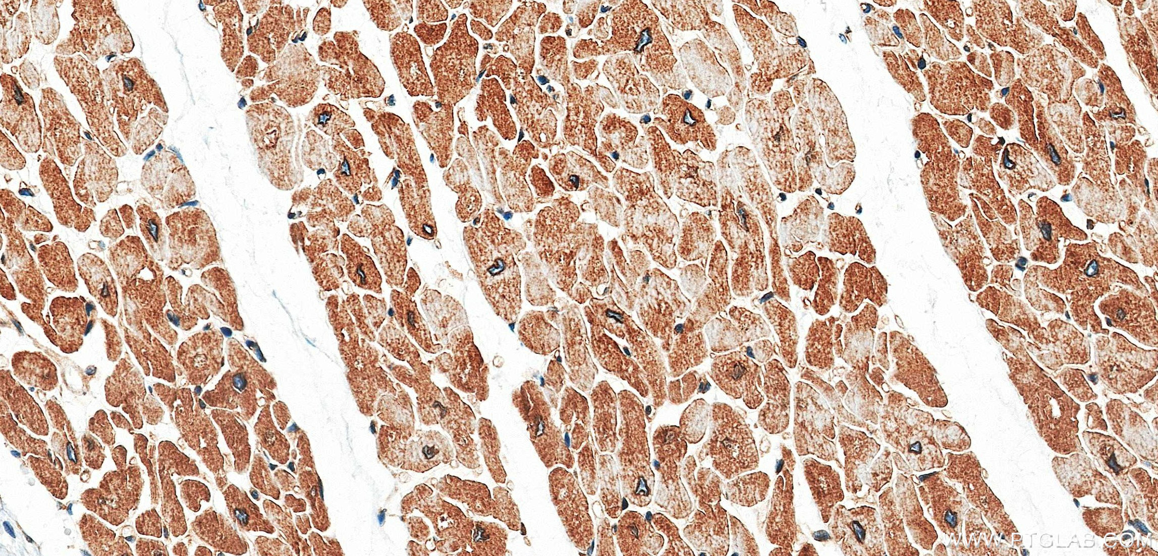 IHC staining of human heart using 87770-3-RR IHC staining of human heart using 87770-3-RR