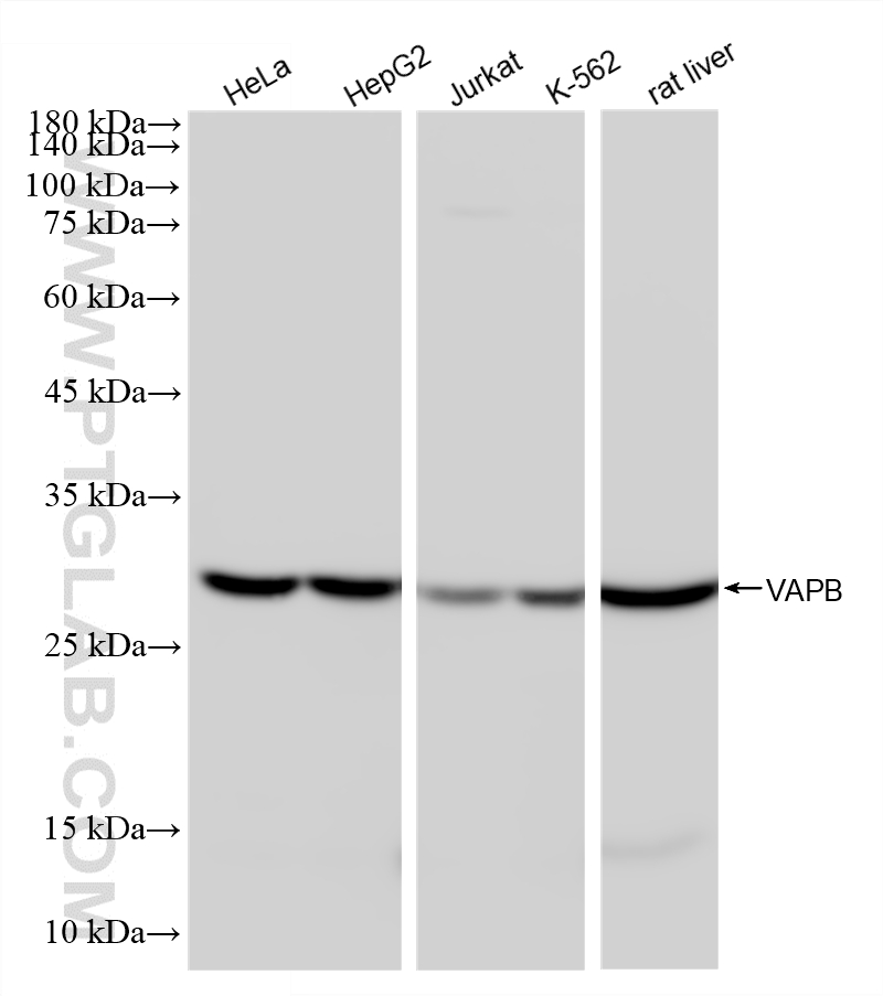 WB analysis using 87770-3-RR WB analysis using 87770-3-RR