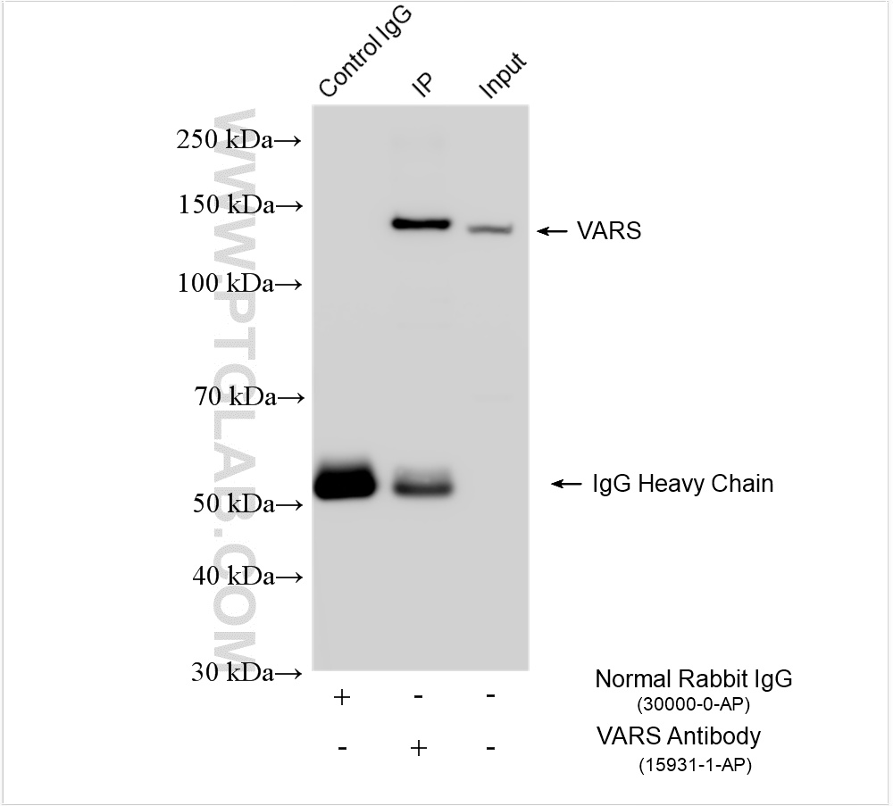 IP experiment of HeLa using 15931-1-AP