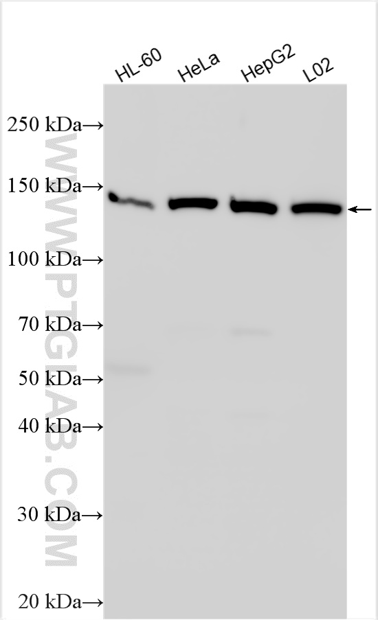 WB analysis using 15931-1-AP