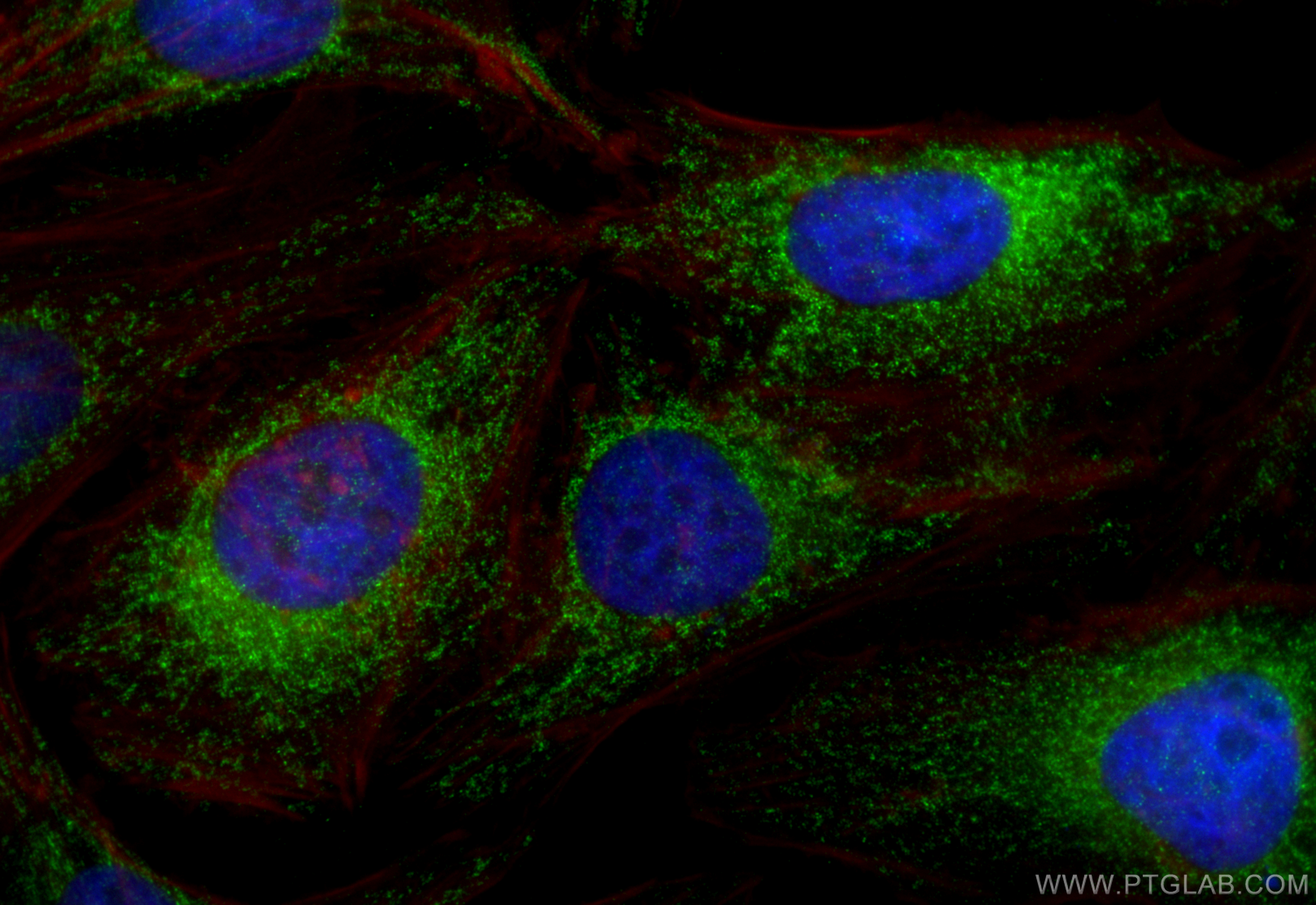 IF Staining of HeLa using 15776-1-AP