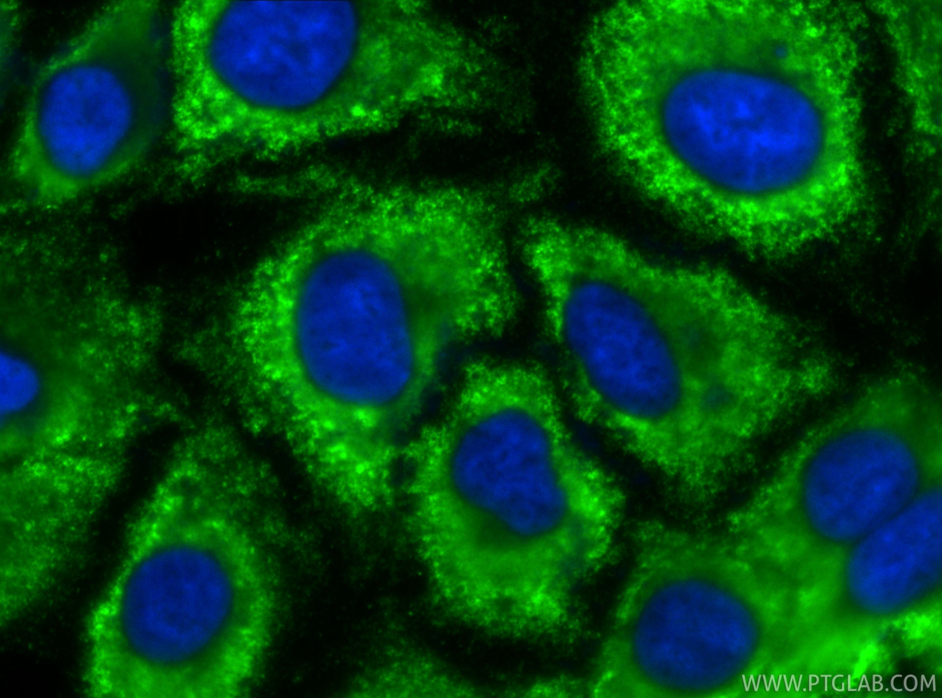 IF Staining of A549 using CL488-67753