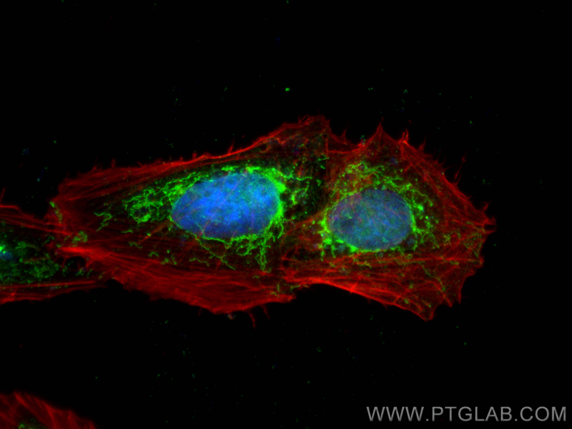 IF Staining of U2OS using 17714-1-AP IF Staining of U2OS using 17714-1-AP
