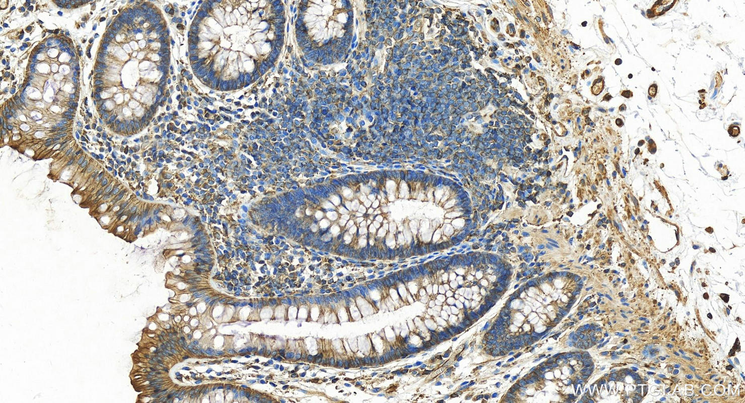 IHC staining of human colon using 13472-1-AP