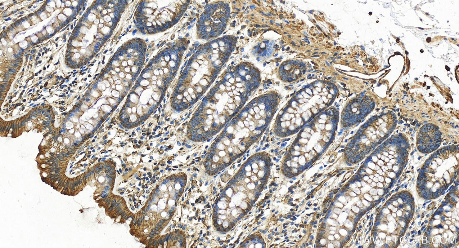 IHC staining of human colon using 13472-1-AP