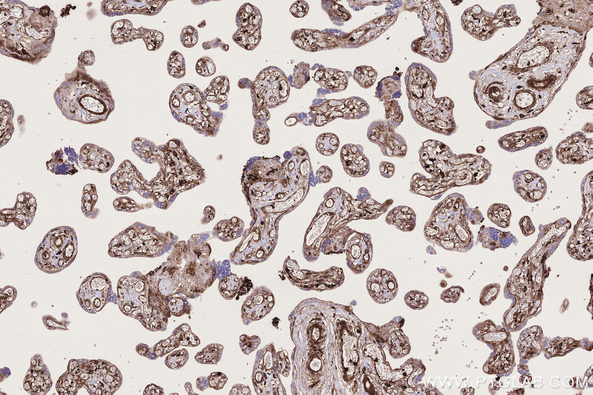 IHC staining of human placenta using 13472-1-AP IHC staining of human placenta using 13472-1-AP