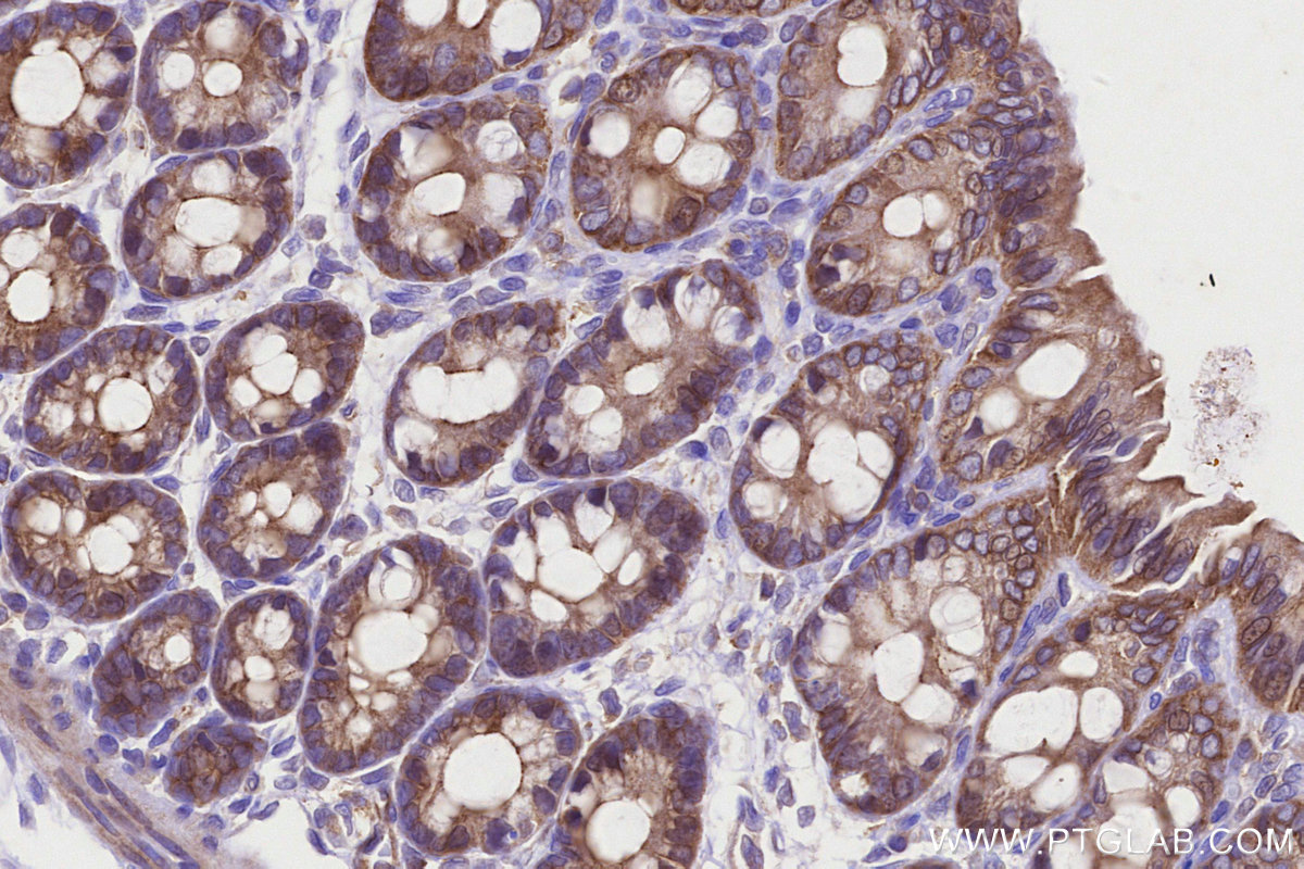IHC staining of rat colon using 13472-1-AP IHC staining of rat colon using 13472-1-AP