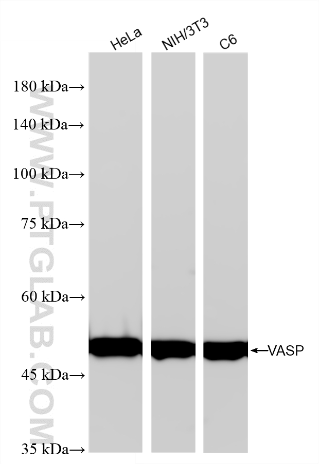 WB analysis using 87104-3-RR (same clone as 87104-3-PBS) WB analysis using 87104-3-RR (same clone as 87104-3-PBS)