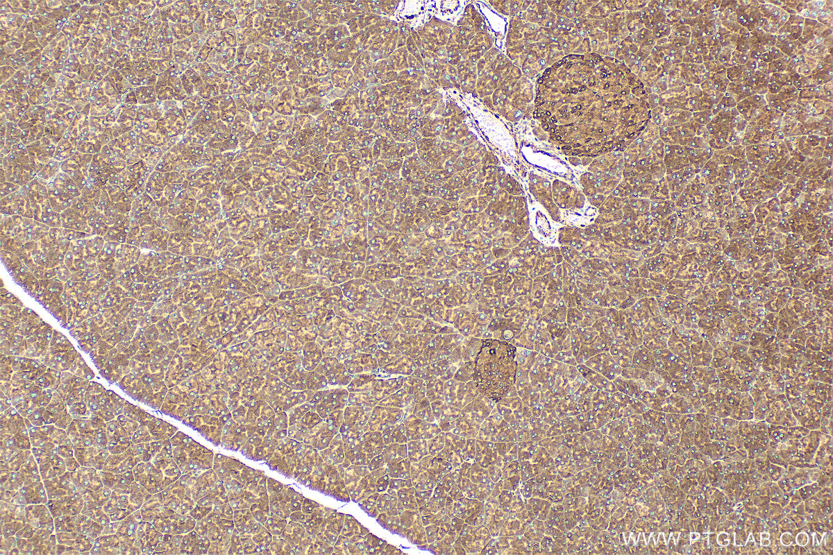 IHC staining of mouse pancreas using 67474-1-Ig (same clone as 67474-1-PBS)
