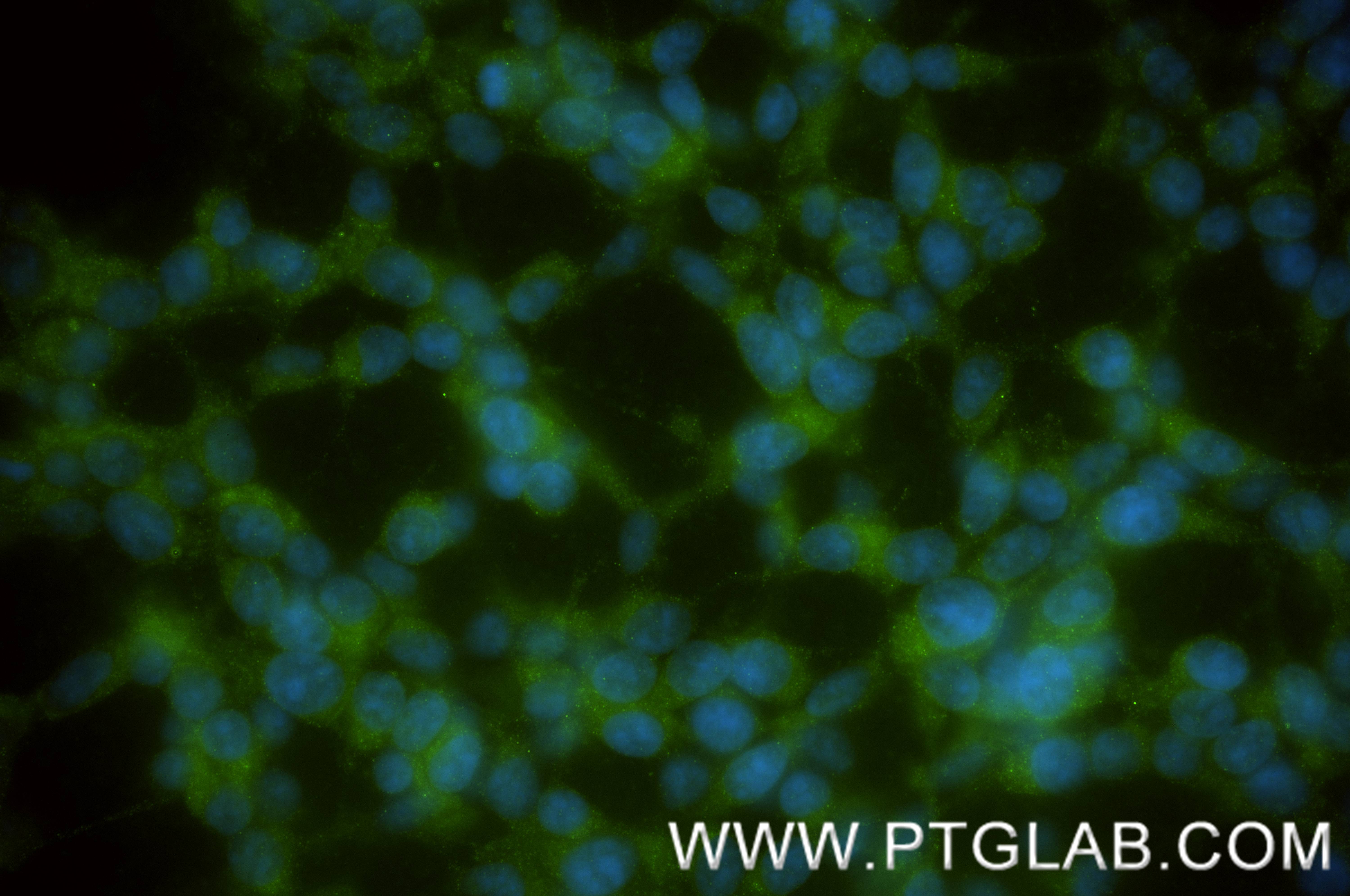 IF Staining of SH-SY5Y using 86847-1-RR