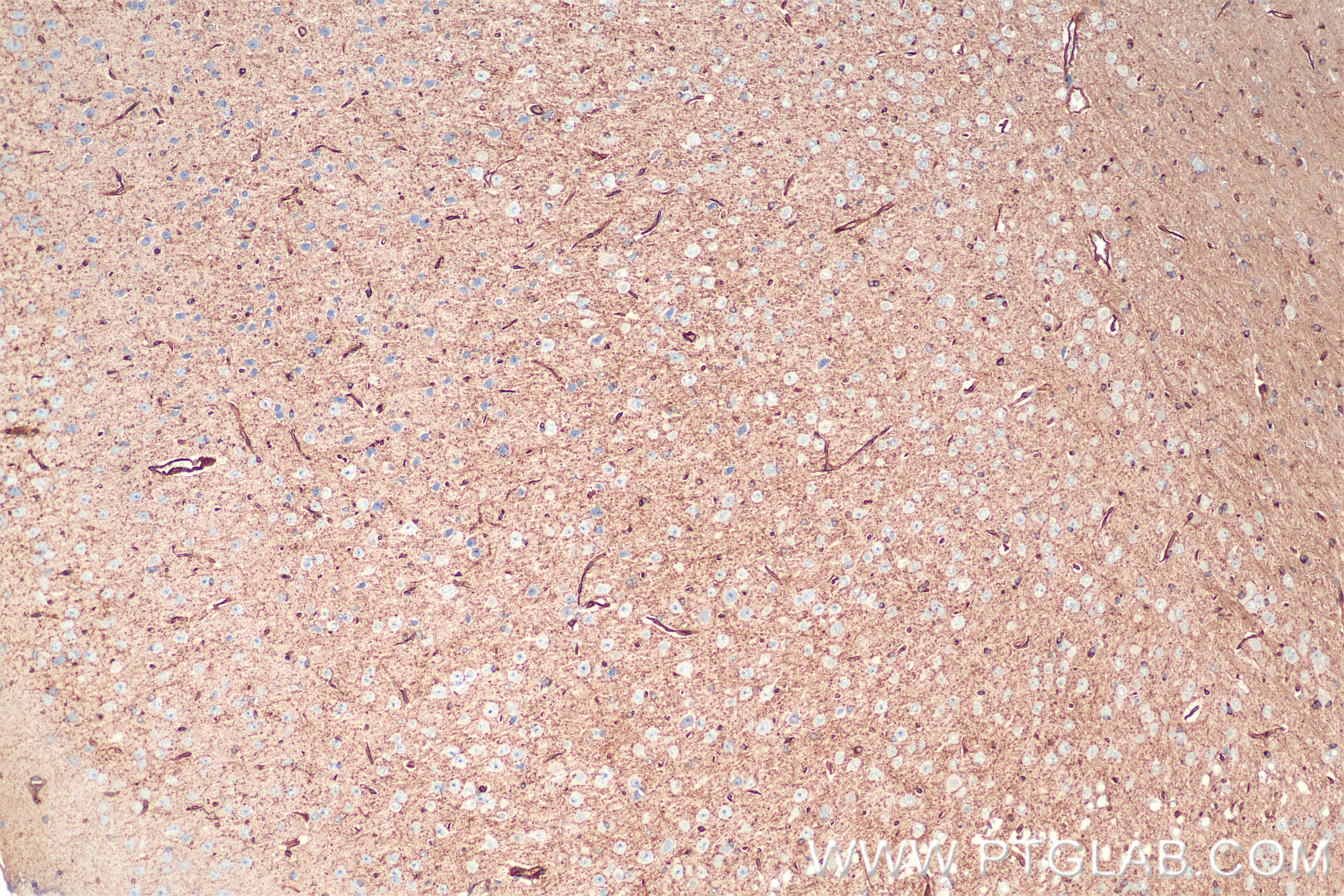 IHC staining of mouse brain using 86847-1-RR