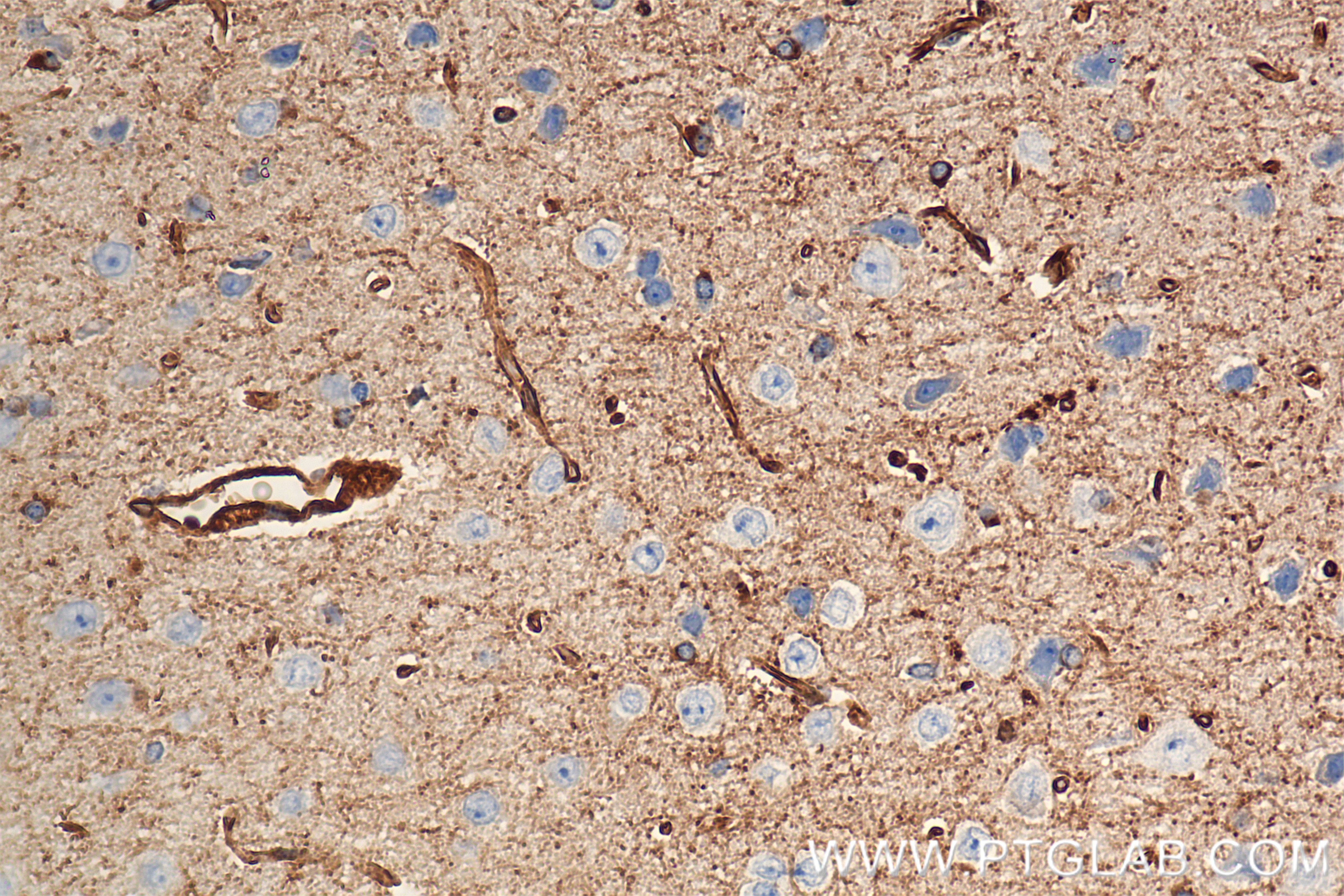 IHC staining of mouse brain using 86847-1-RR