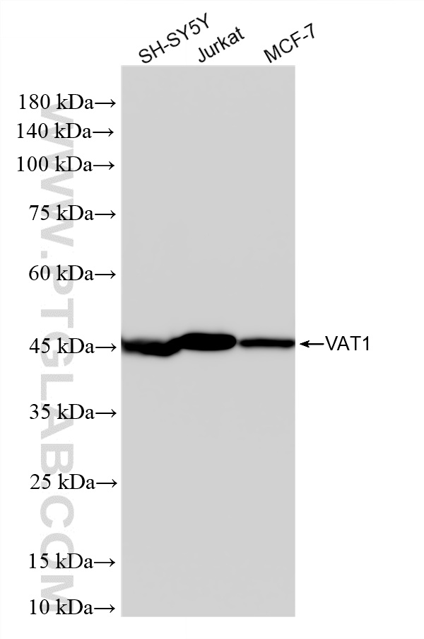 WB analysis using 86847-1-RR