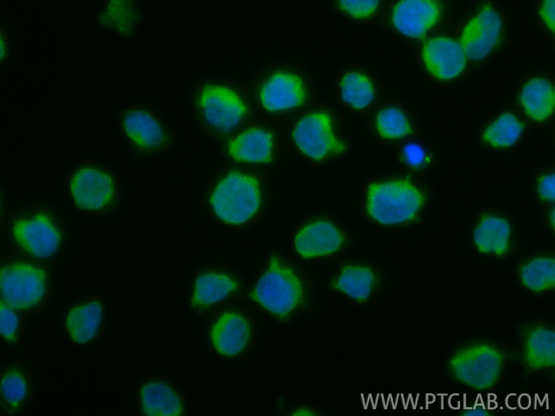 IF Staining of Jurkat using CL488-86933-2 IF Staining of Jurkat using CL488-86933-2