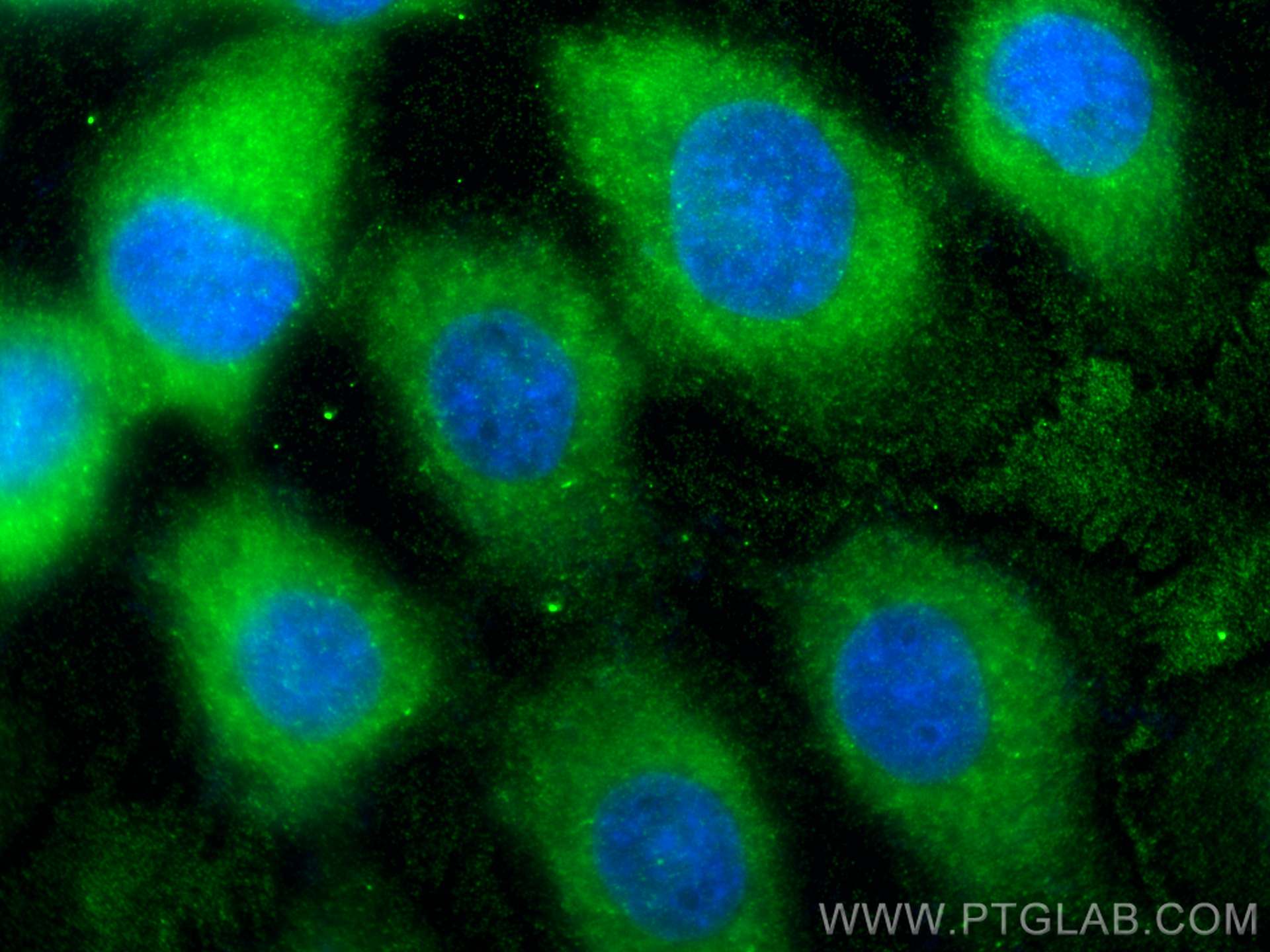 IF Staining of A431 using 67108-1-Ig (same clone as 67108-1-PBS)