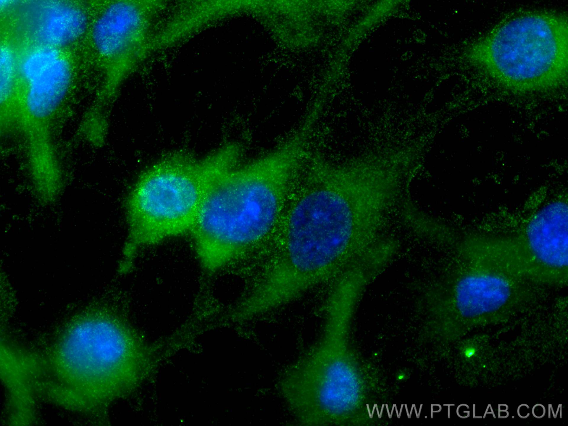 IF Staining of HUVEC using 67108-1-Ig (same clone as 67108-1-PBS)