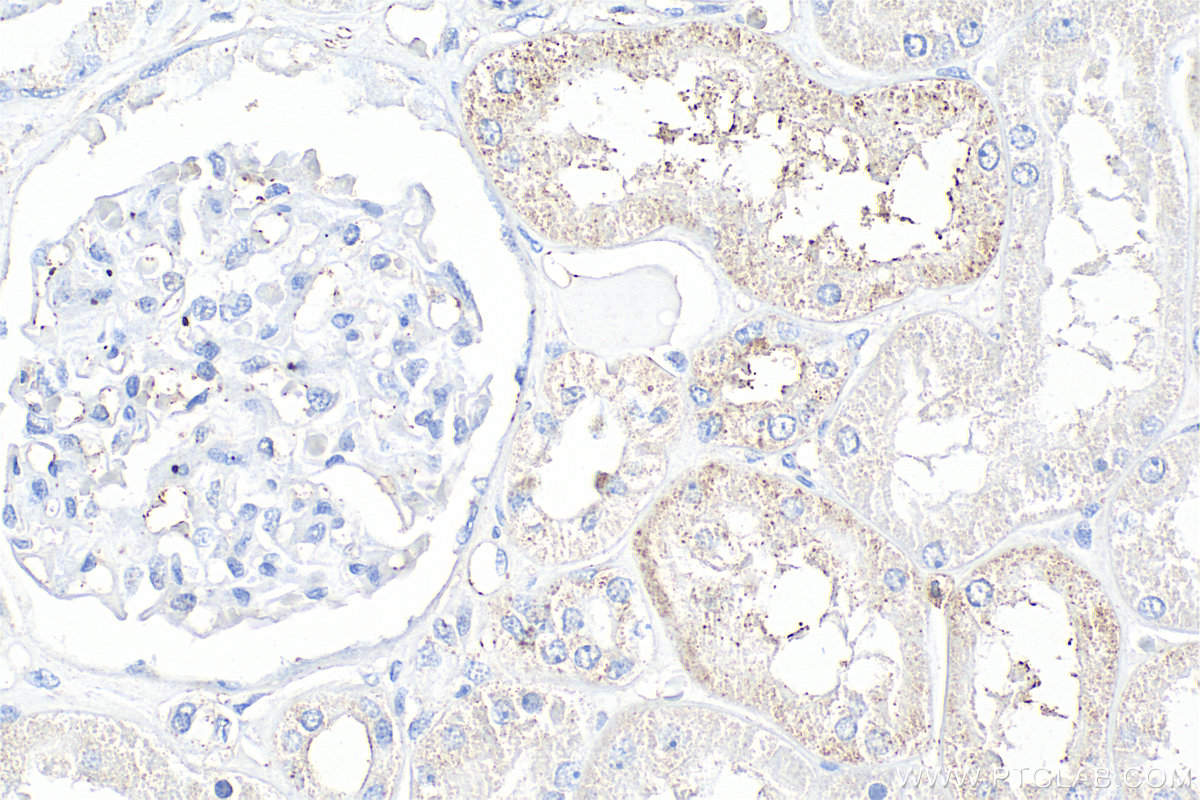 IHC staining of human kidney using 30291-1-AP