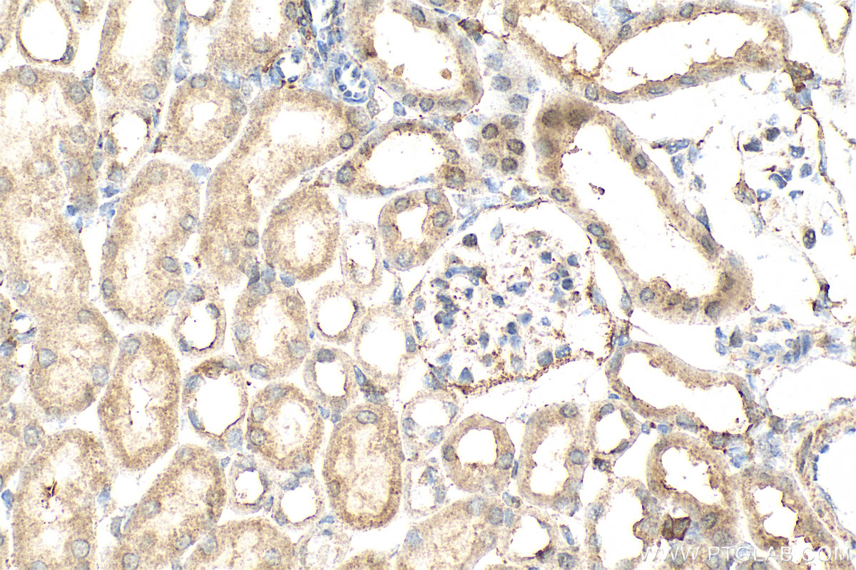 IHC staining of mouse kidney using 30291-1-AP