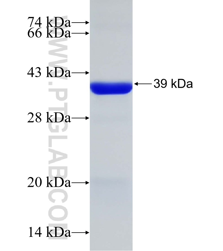 VAV3 fusion protein Ag32949 SDS-PAGE VAV3 fusion protein Ag32949 SDS-PAGE
