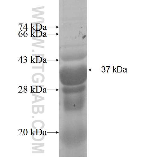VAX2 fusion protein Ag8160 SDS-PAGE VAX2 fusion protein Ag8160 SDS-PAGE