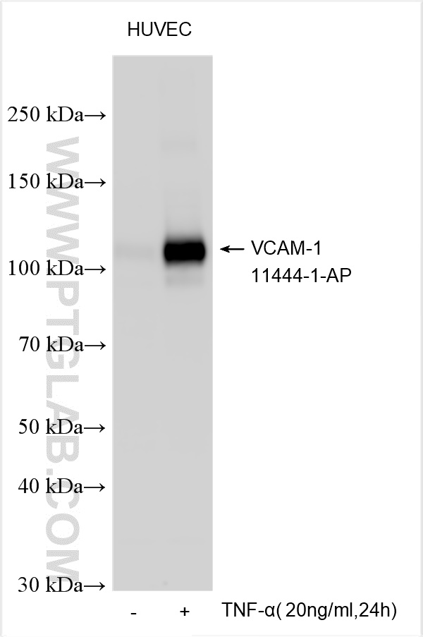 WB analysis using 11444-1-AP